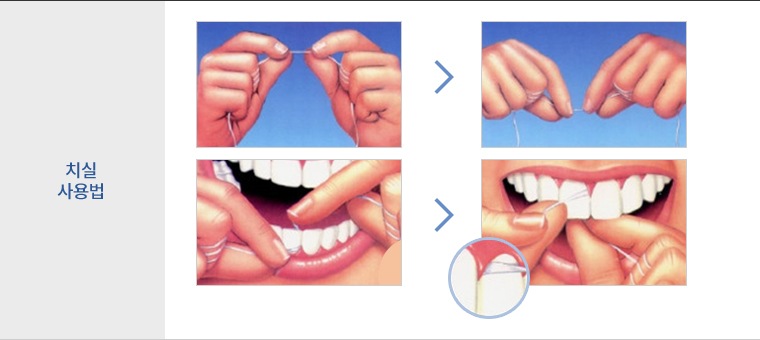 치실사용법