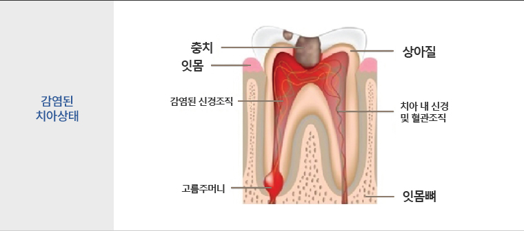 치료과정